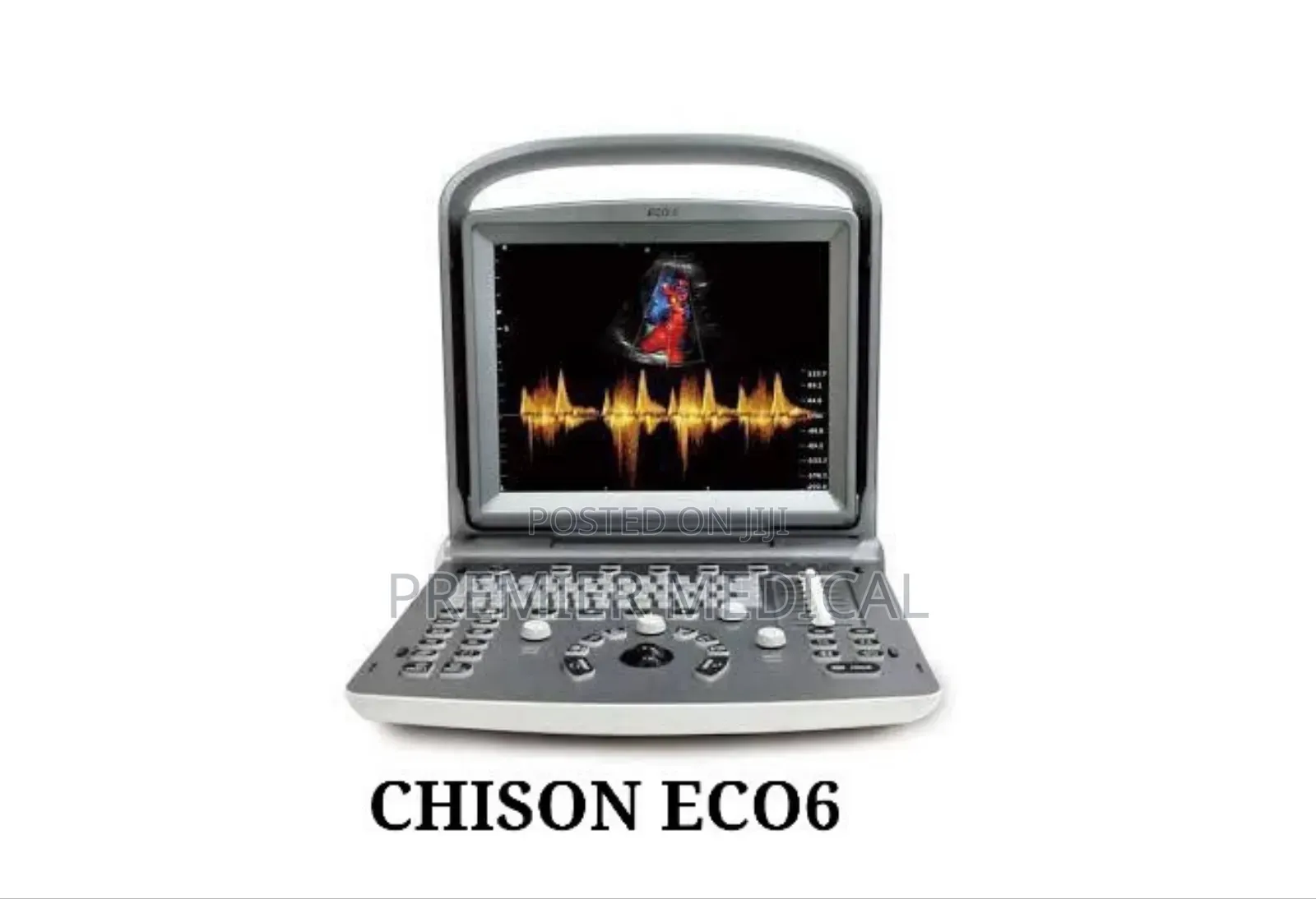Chison Eco 6 Color Doppler Ultrasound