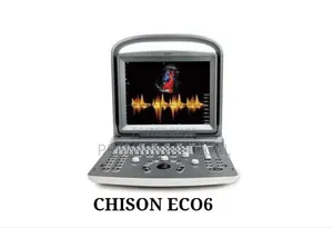 Chison Eco 6 Color Doppler Ultrasound
