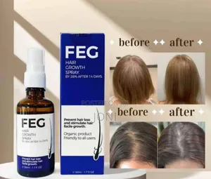 Photo - Original Feg Hair Growth Spray