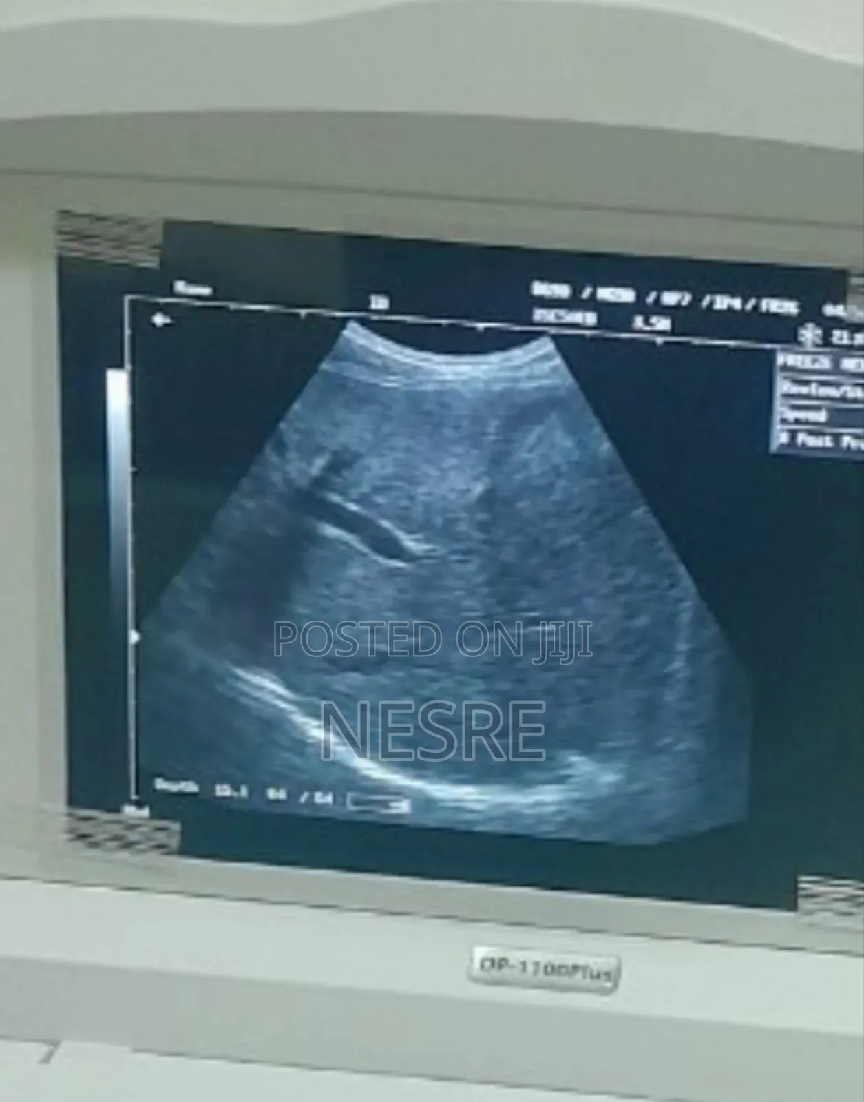 Mindray Ultrasound