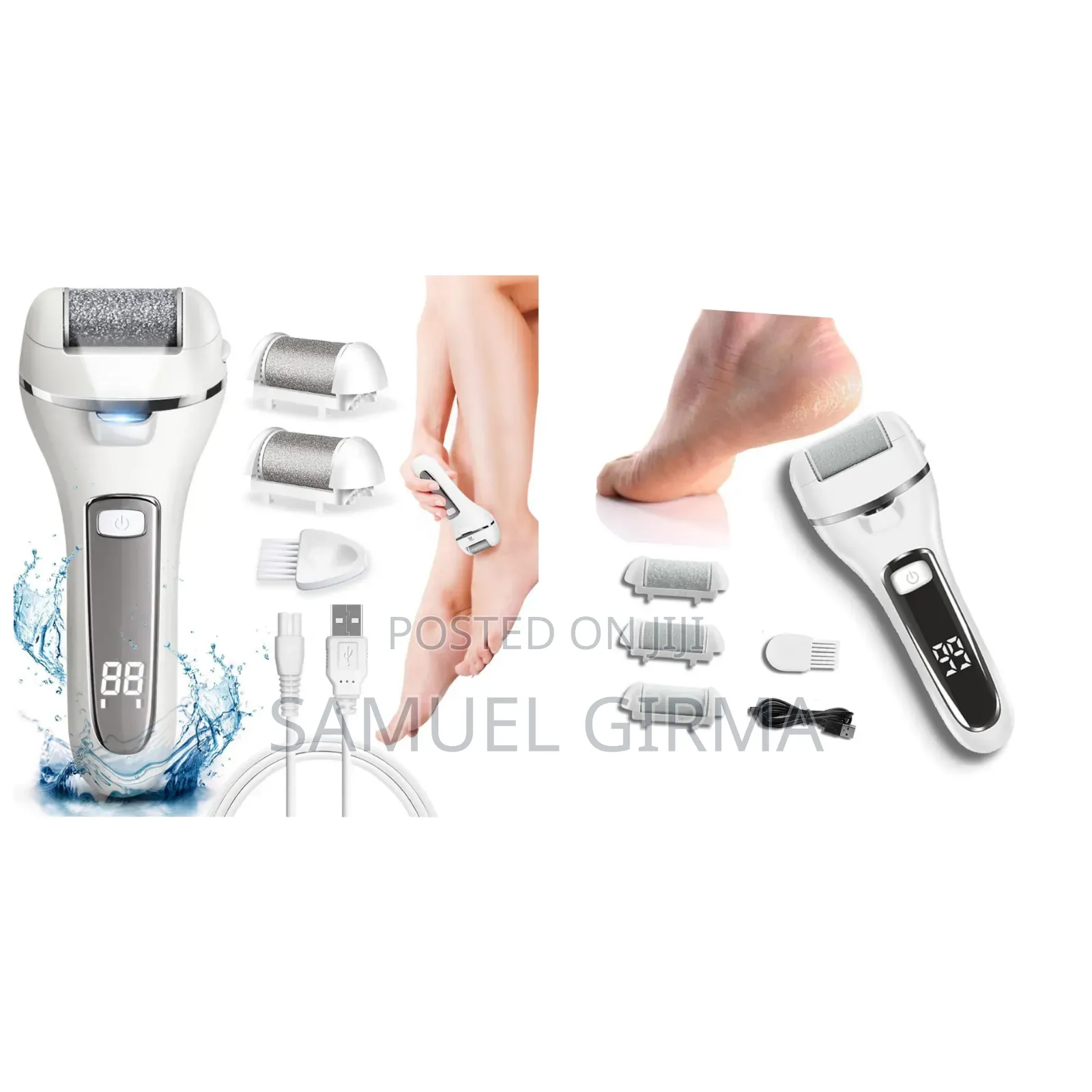 An Electric Foot Callus Remover