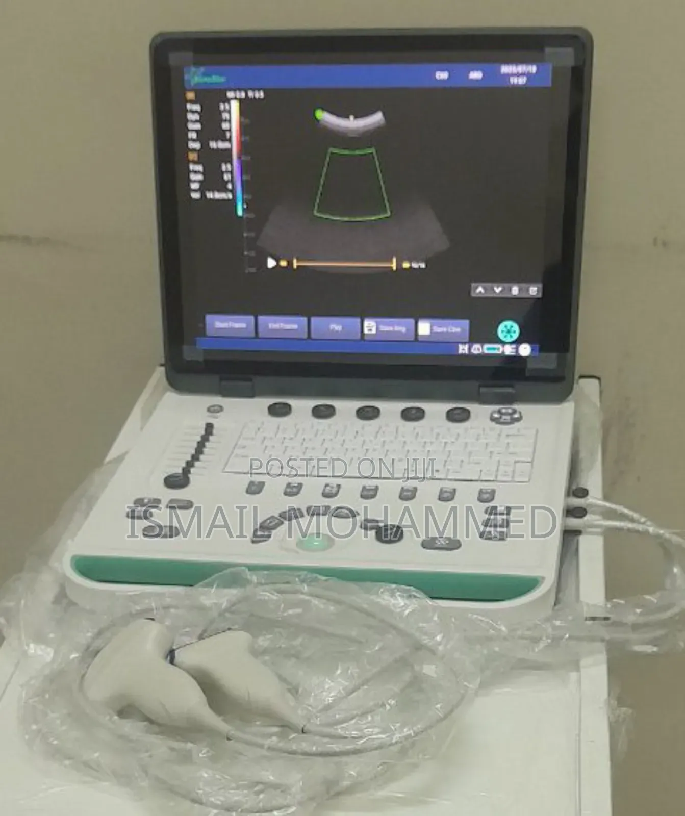Sonostar Color Doppler Ultrasound