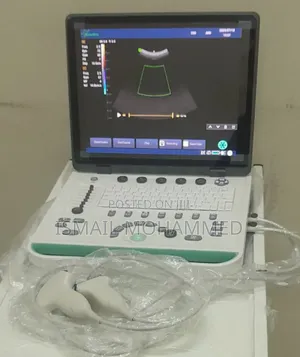 Photo - Sonostar Color Doppler Ultrasound