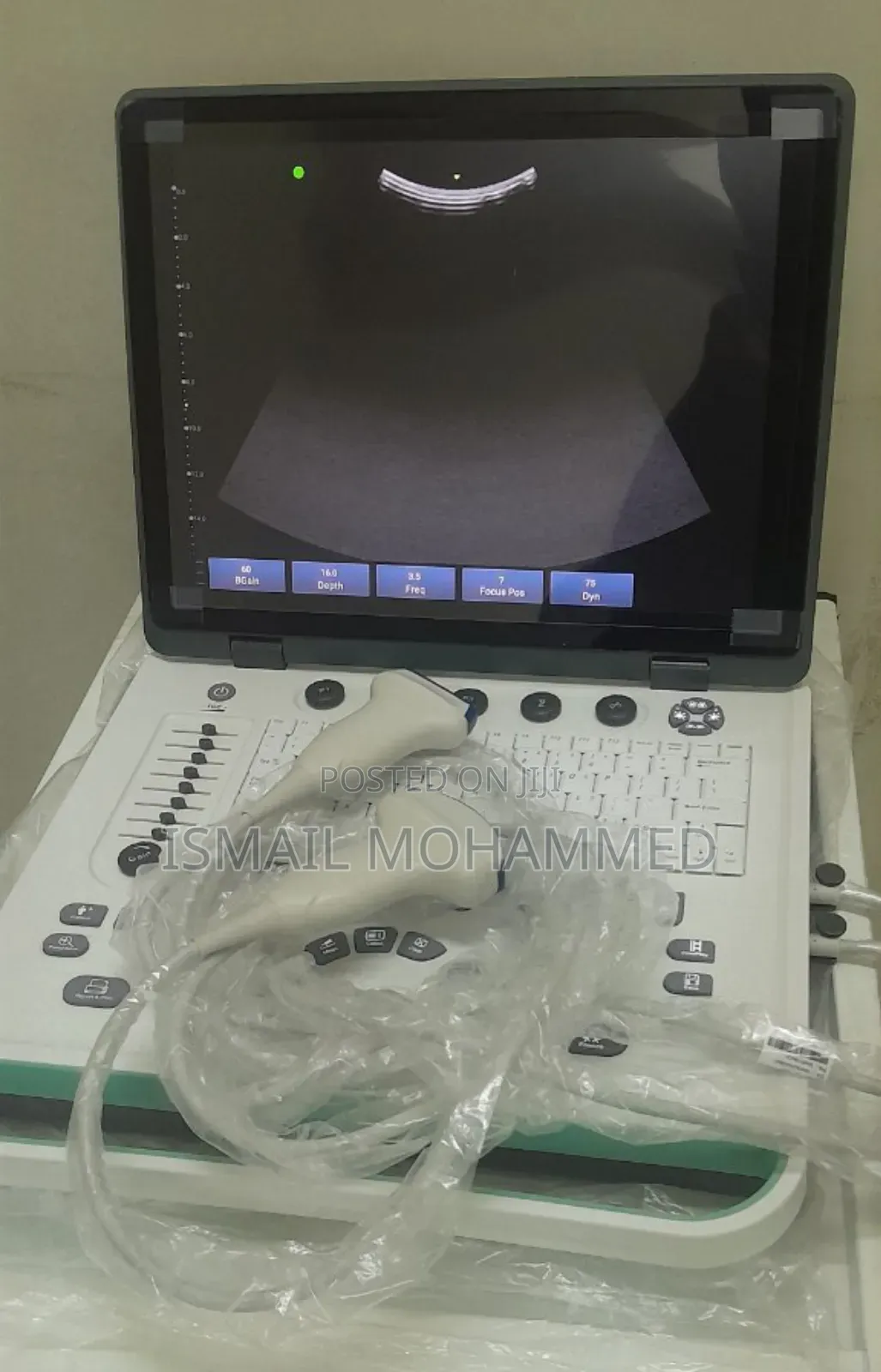 Sonostar Color Doppler Ultrasound