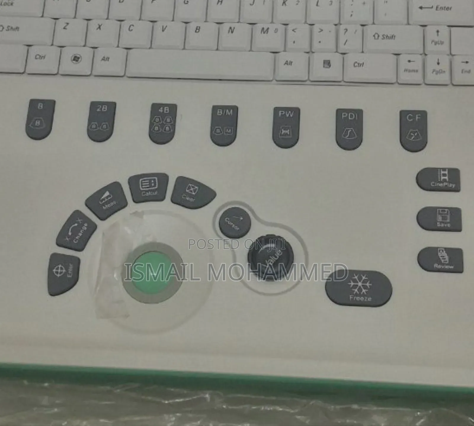 Sonostar Color Doppler Ultrasound