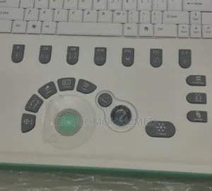 Sonostar Color Doppler Ultrasound