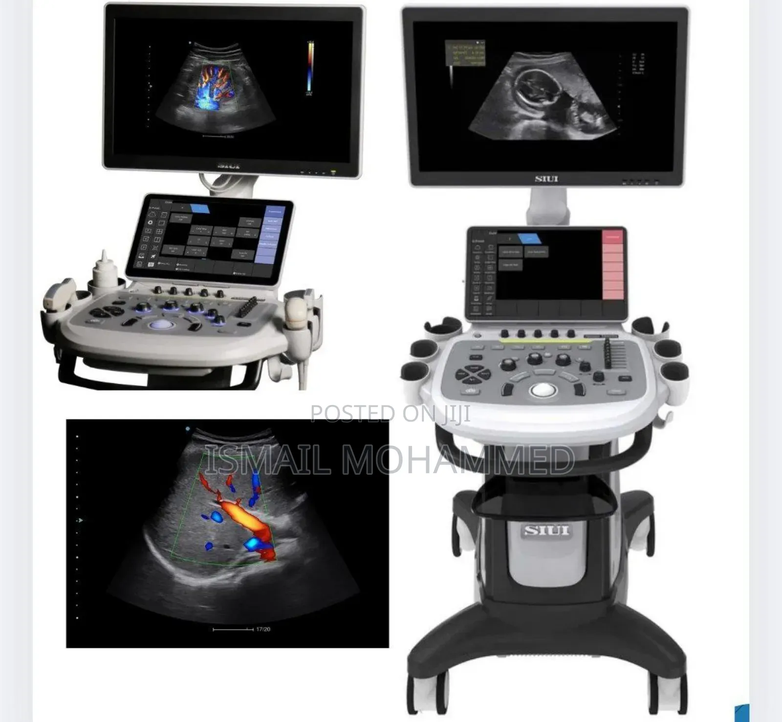 Digital Color Doppler Ultrasound