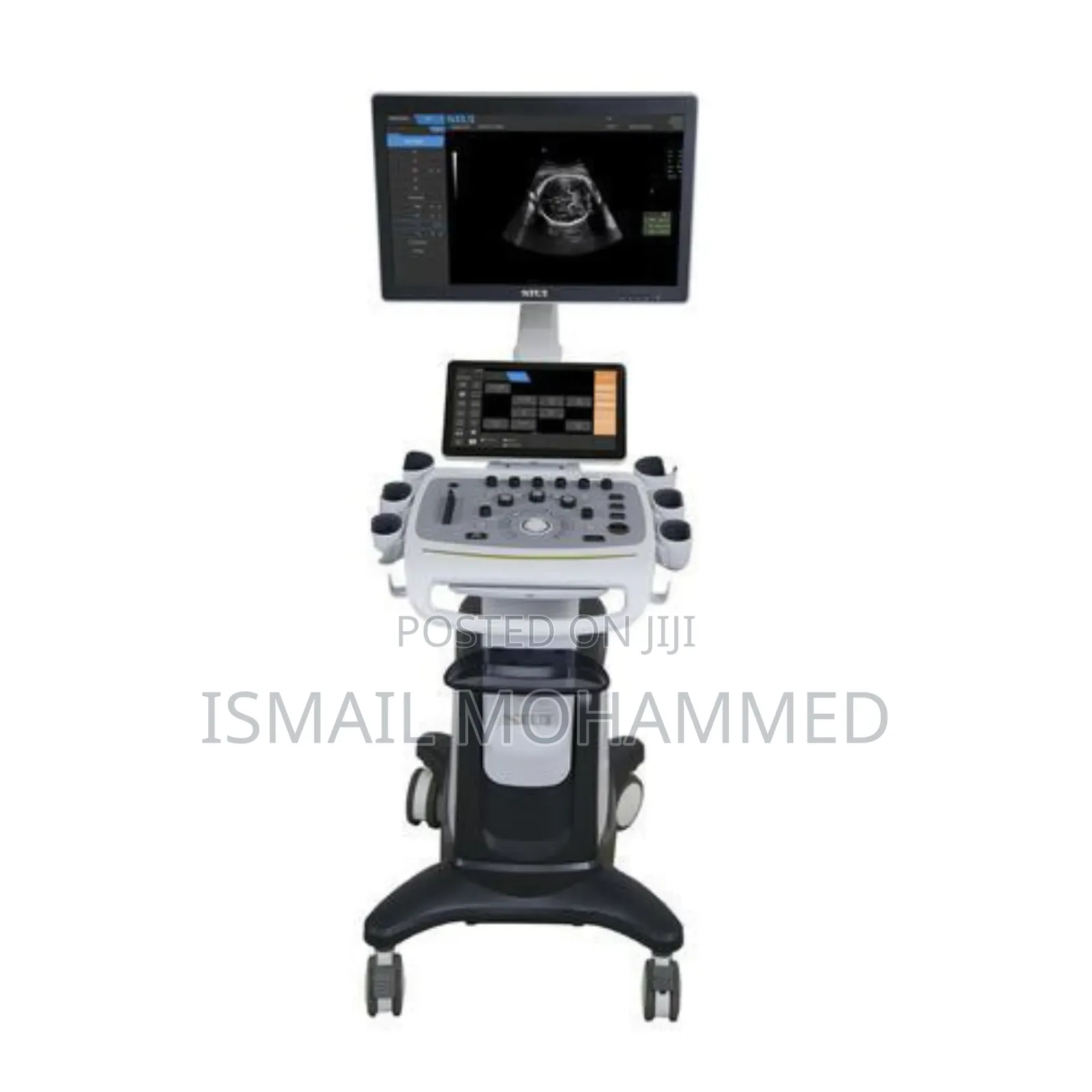 Digital Color Doppler Ultrasound