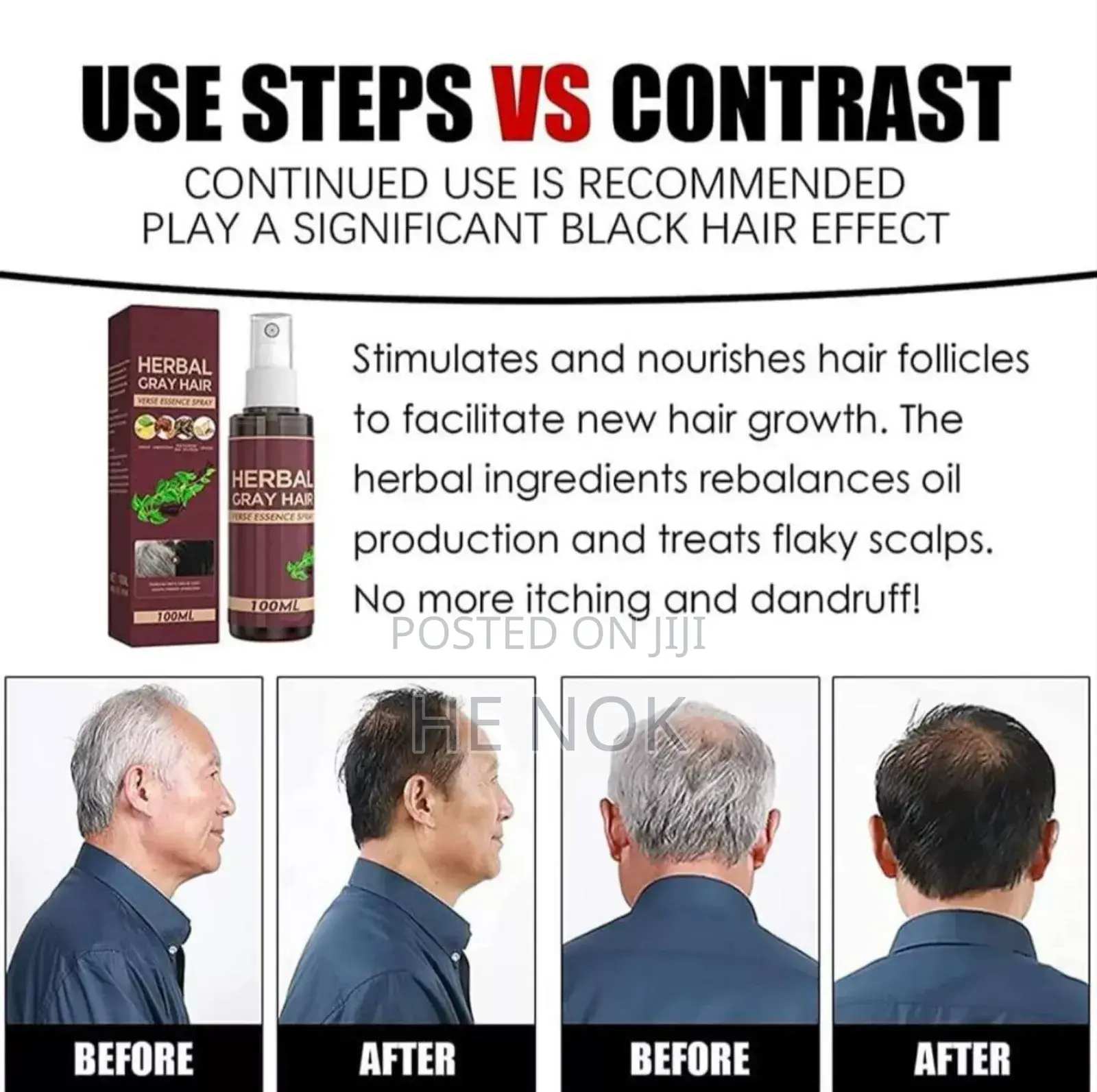 ጅምላ ሸያጭ Bulk Sale Herbal Hair Darkening ሽበትን በቋሚነት የሚያጠፋ