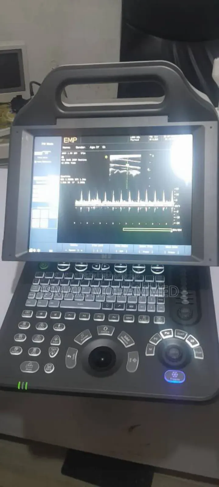 Emp N-2 Ultrasound