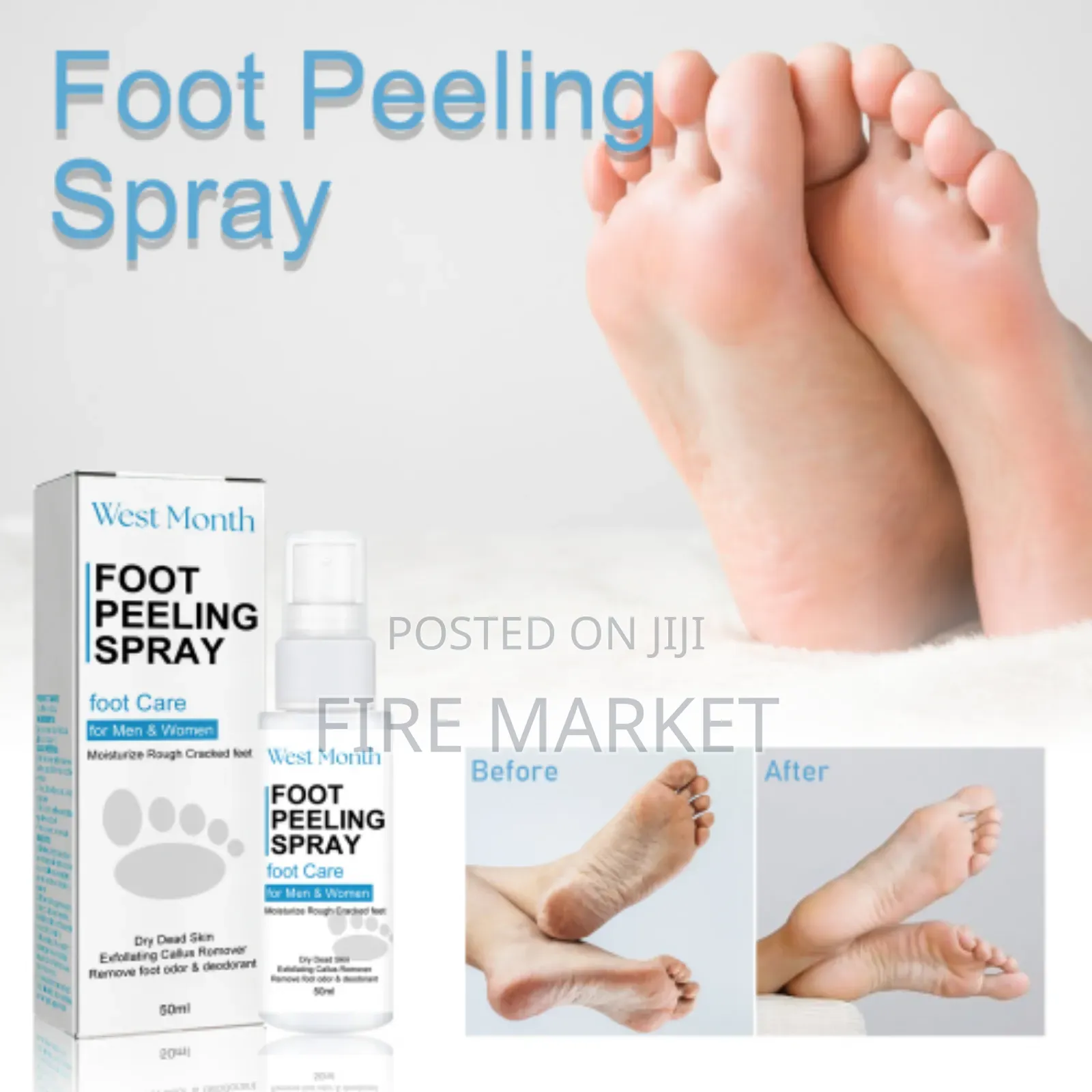 Foot Peeling Spray ላብ እና የእግር ሽታ ዘላቂ መፍትሄ
