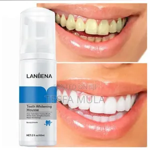 Photo - Lanbena Teeth Whiting ጥርስ ያነፃል
