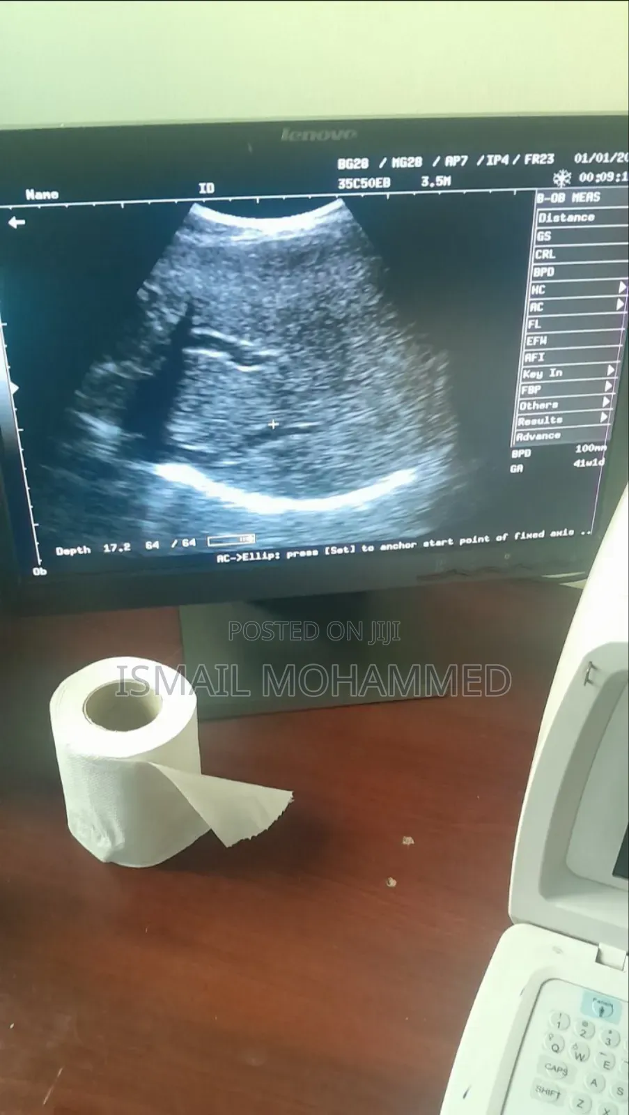 Mindray Dp1100 Plus Ultrasound