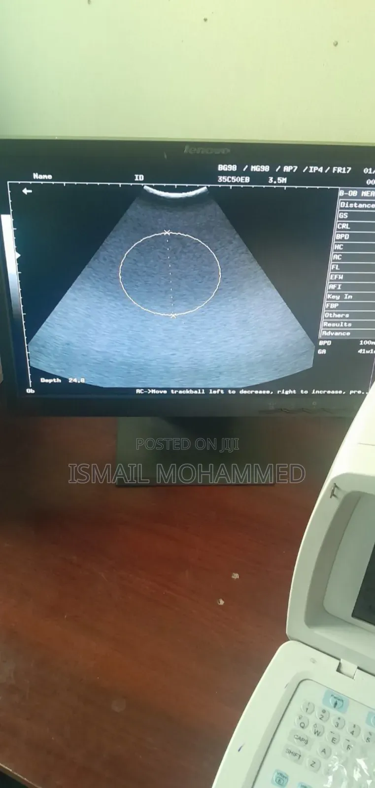 Mindray Dp1100 Plus Ultrasound
