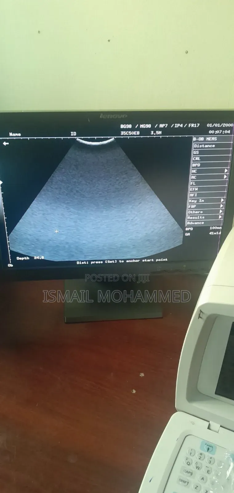 Mindray Dp1100 Plus Ultrasound