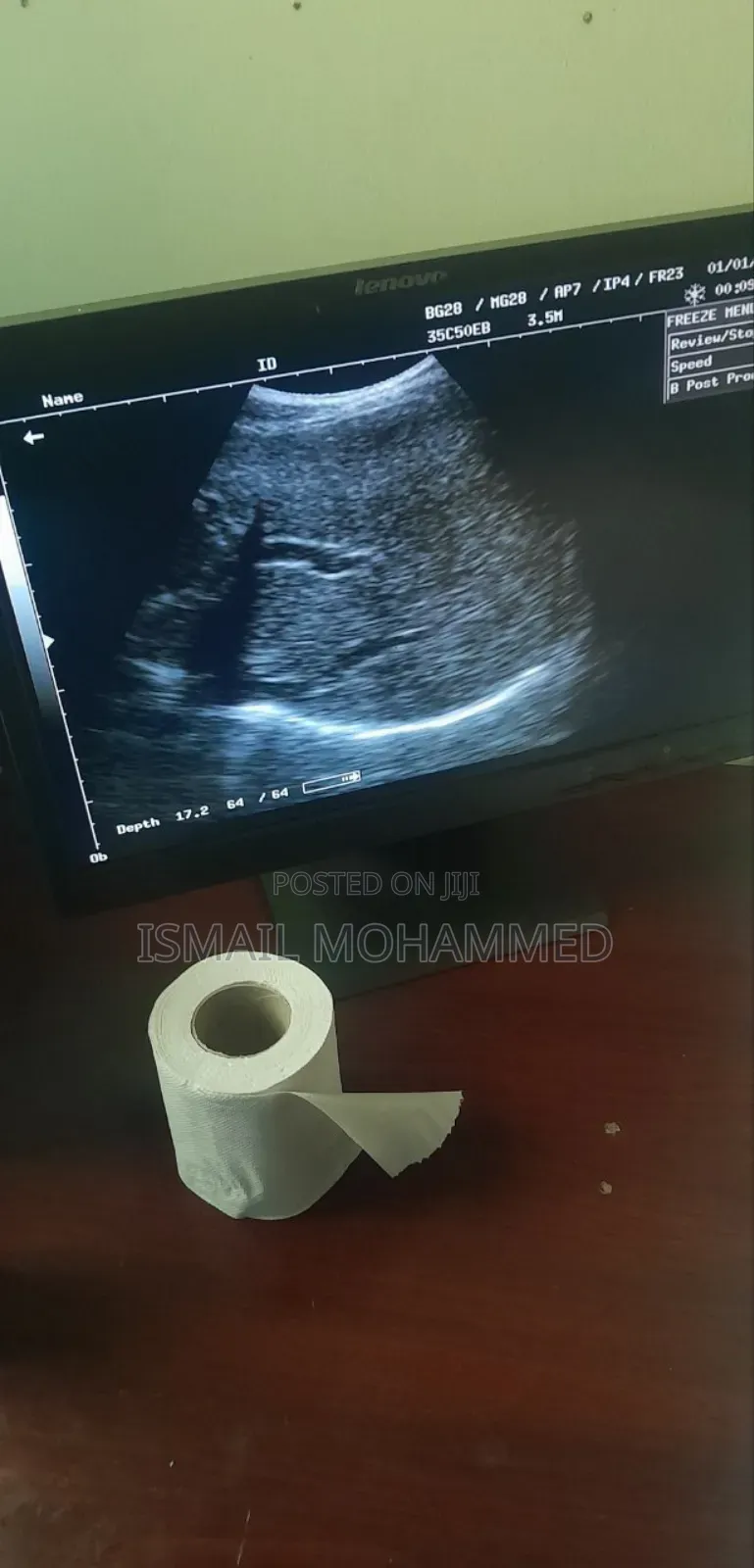 Mindray Dp1100 Plus Ultrasound