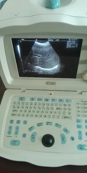 Photo - Mindray Dp-1100 Plus Ultrasound