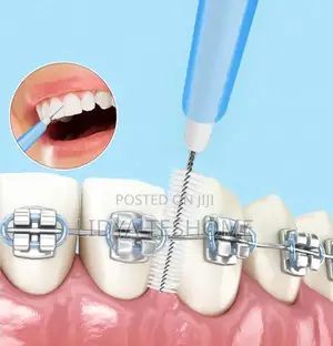 Photo - Interdental Brush for Braces