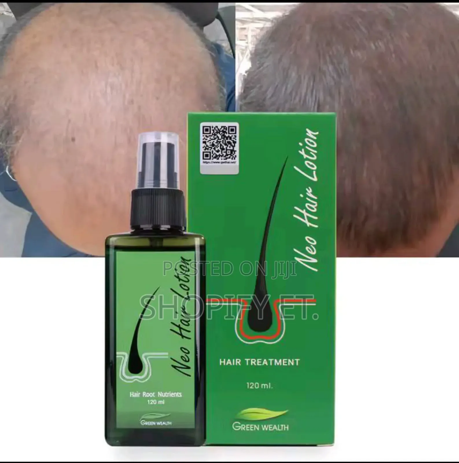 Neo Hair Lotion (Thailand)