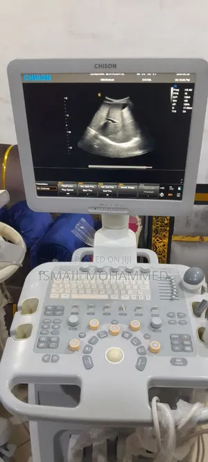 Photo - Chison I-3 Model Color Doppler Ultrasound Machine