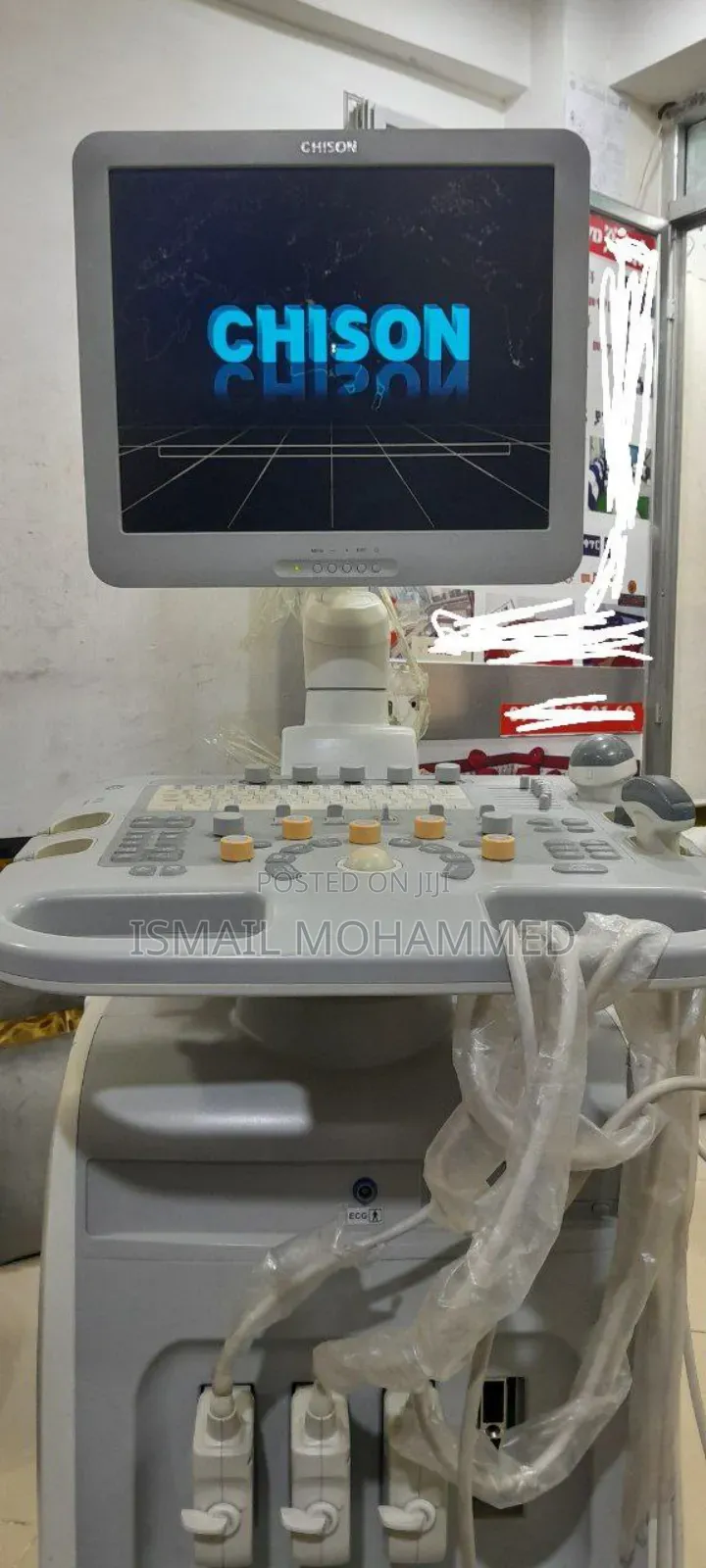 Chison I-3 Model Color Doppler Ultrasound Machine