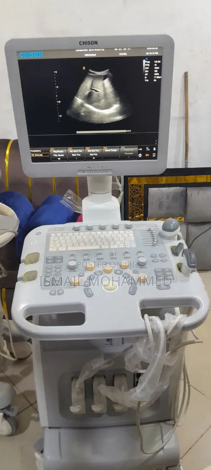 Chison I-3 Model Color Doppler Ultrasound Machine