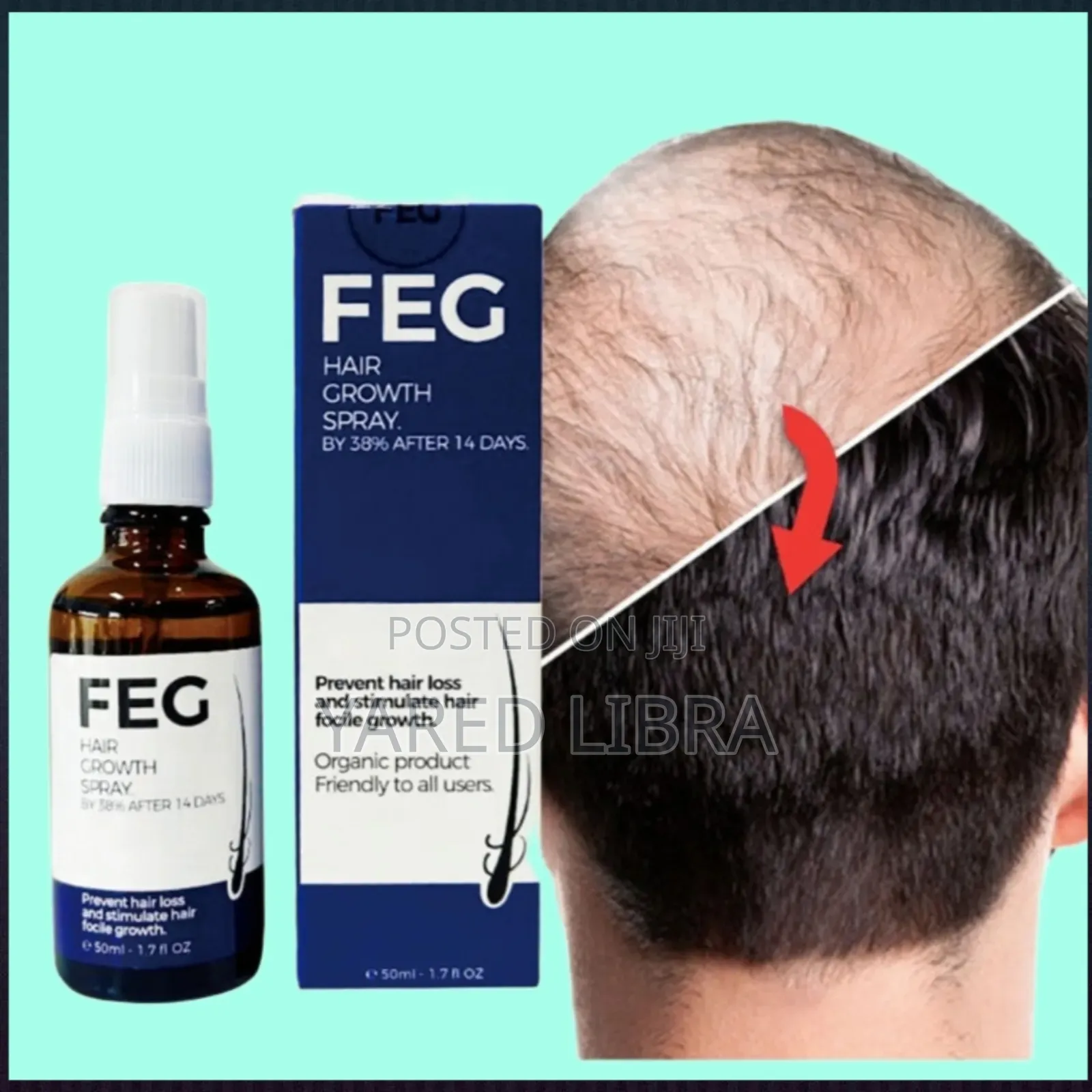 የተመለጠ ፀጉር ያሳድጋል