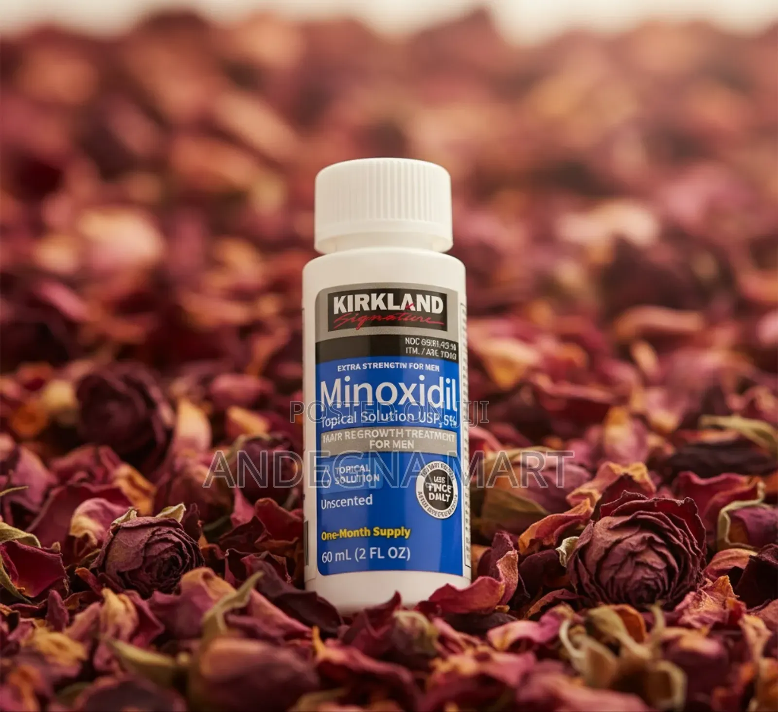 Try This Minoxidil and Witness the Transformation.