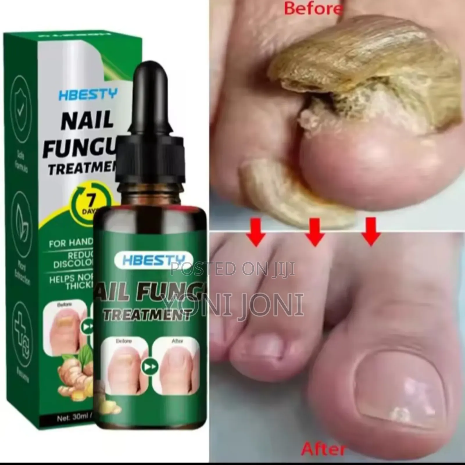 Nail Repair Nail Treatment