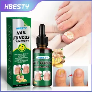 Photo - Nail Bacteria, Fungus Treatment