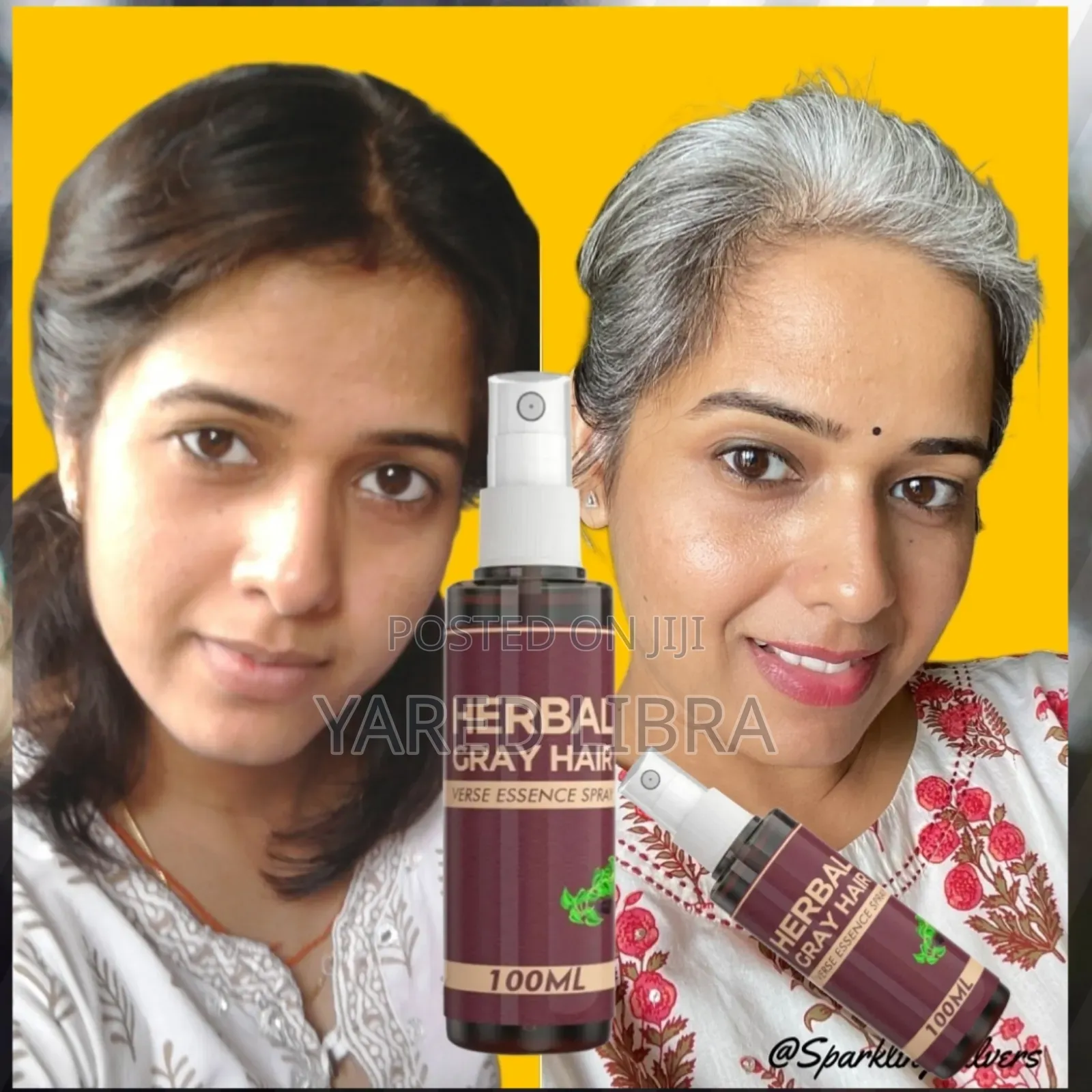 Herbal ሽበት በዘላቂነት ያጠፋል