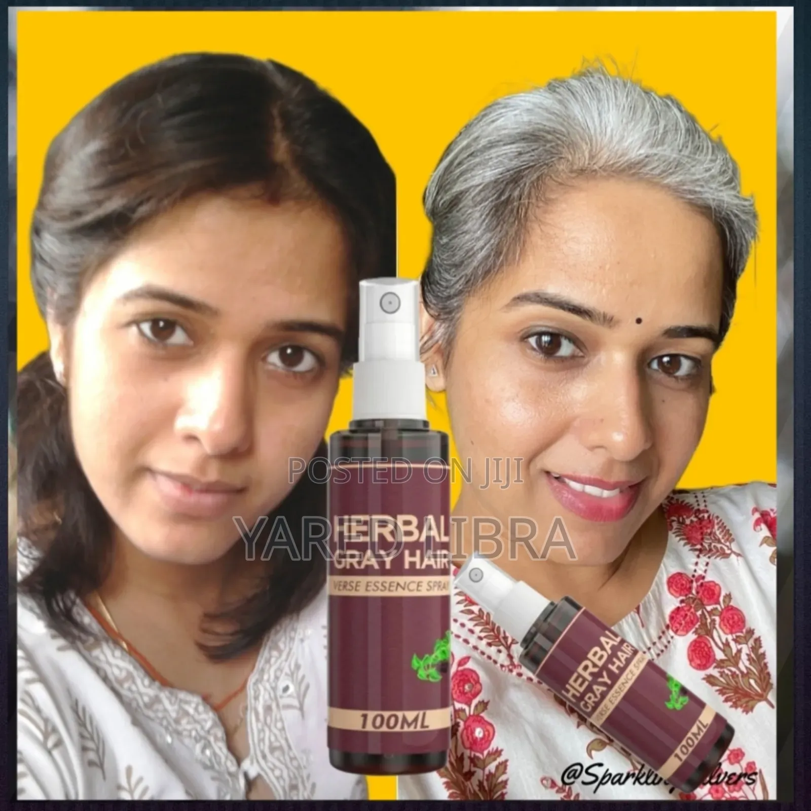 Herbal ሽበት በዘላቂነት ያጠፋል