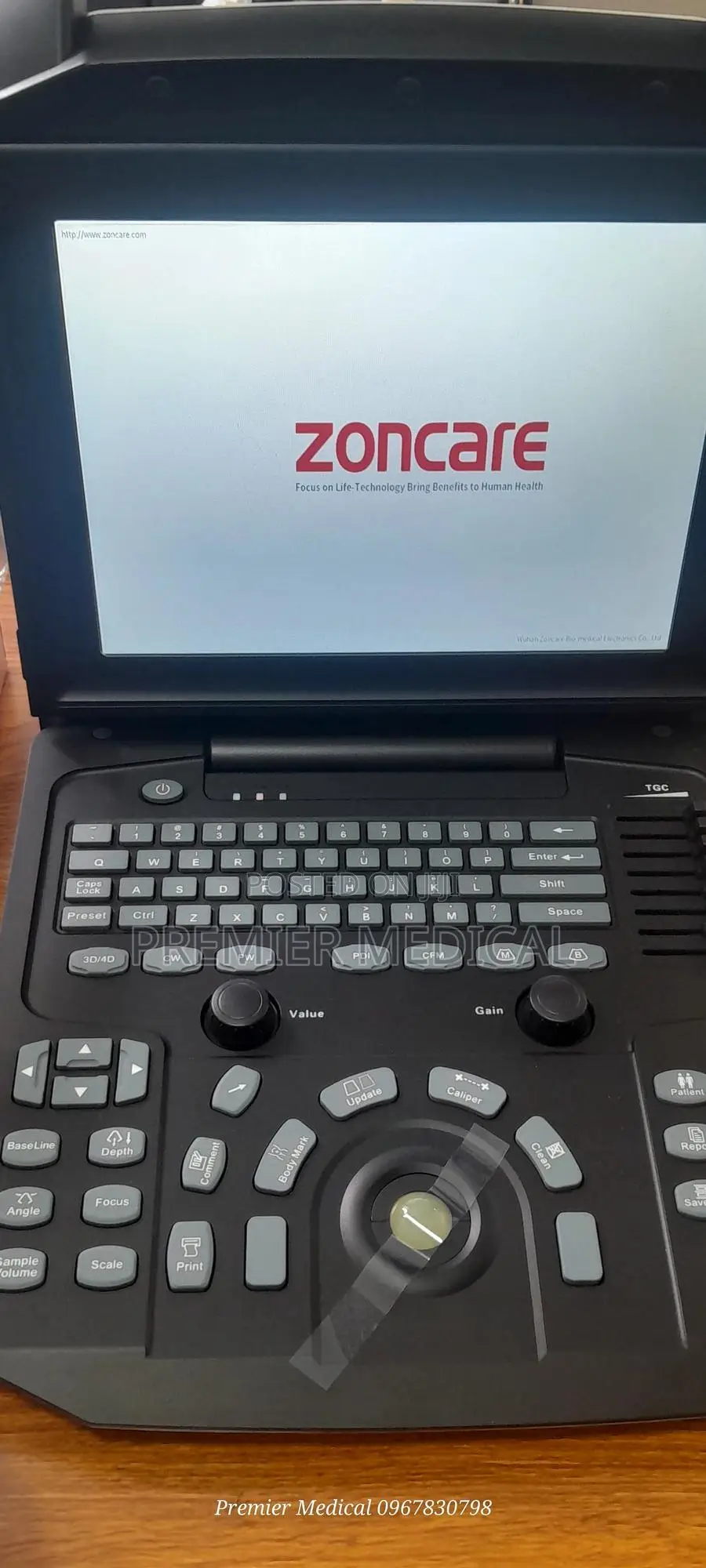 Zoncare Ultrasound Machine