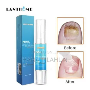 Lanthome Nair Repair