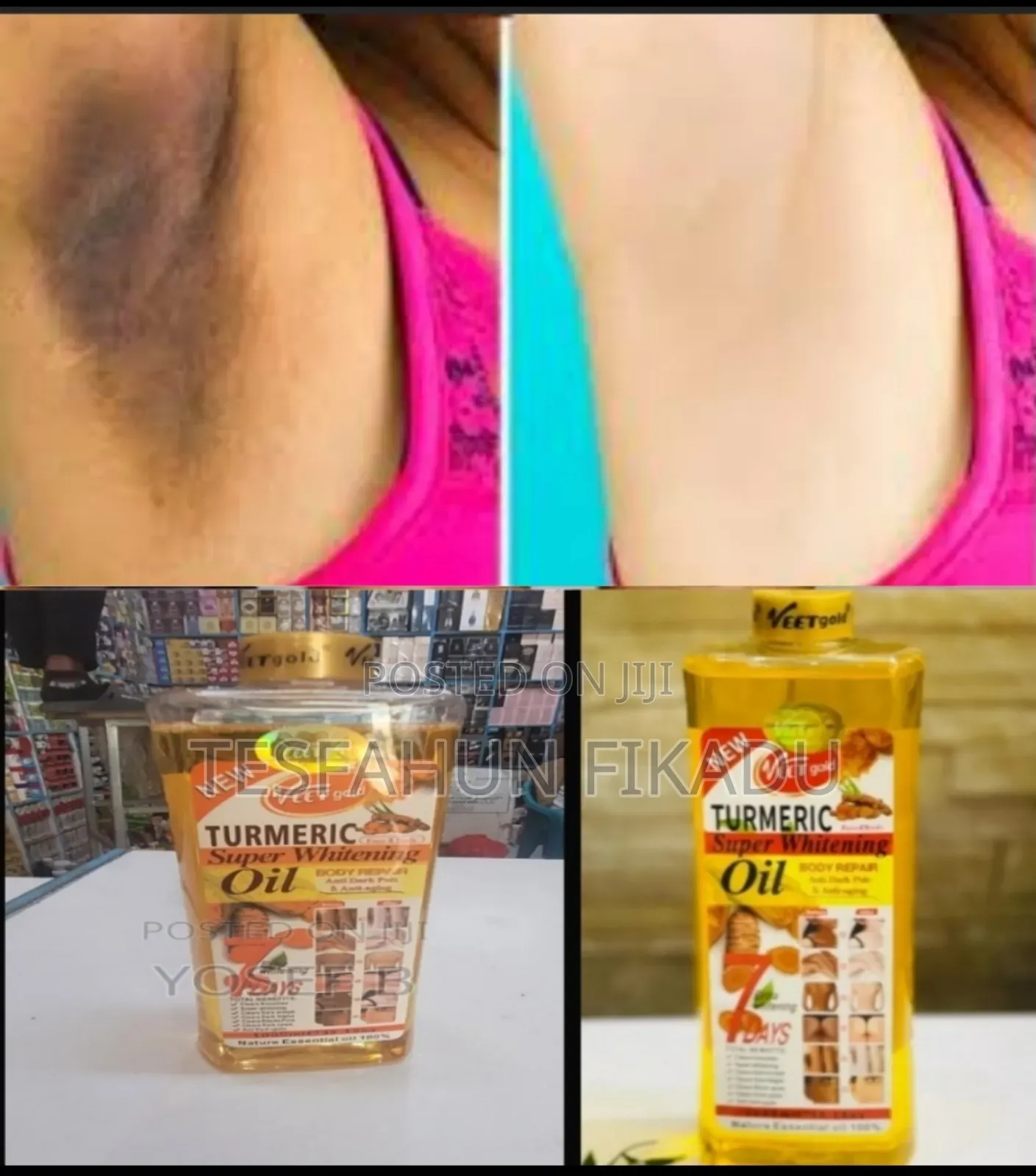 Veetgold Turmeric Whtining Oil