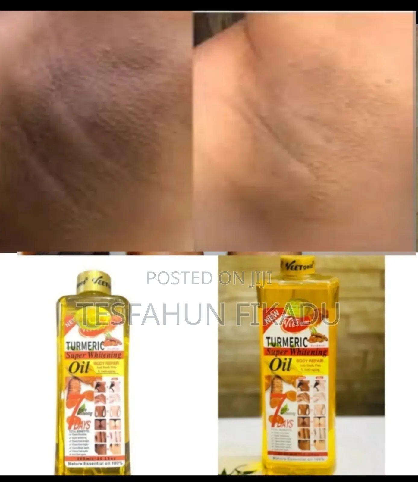 Veetgold Turmeric Whtining Oil