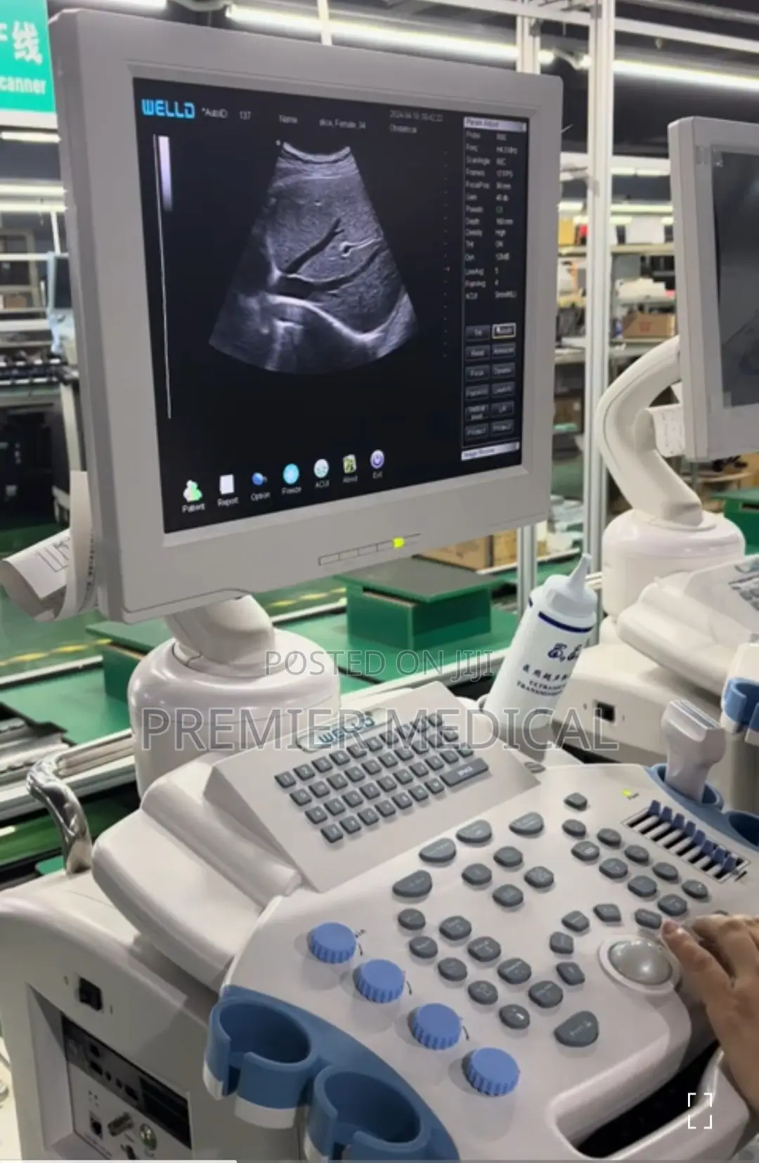 Full Digital Ultrasound System