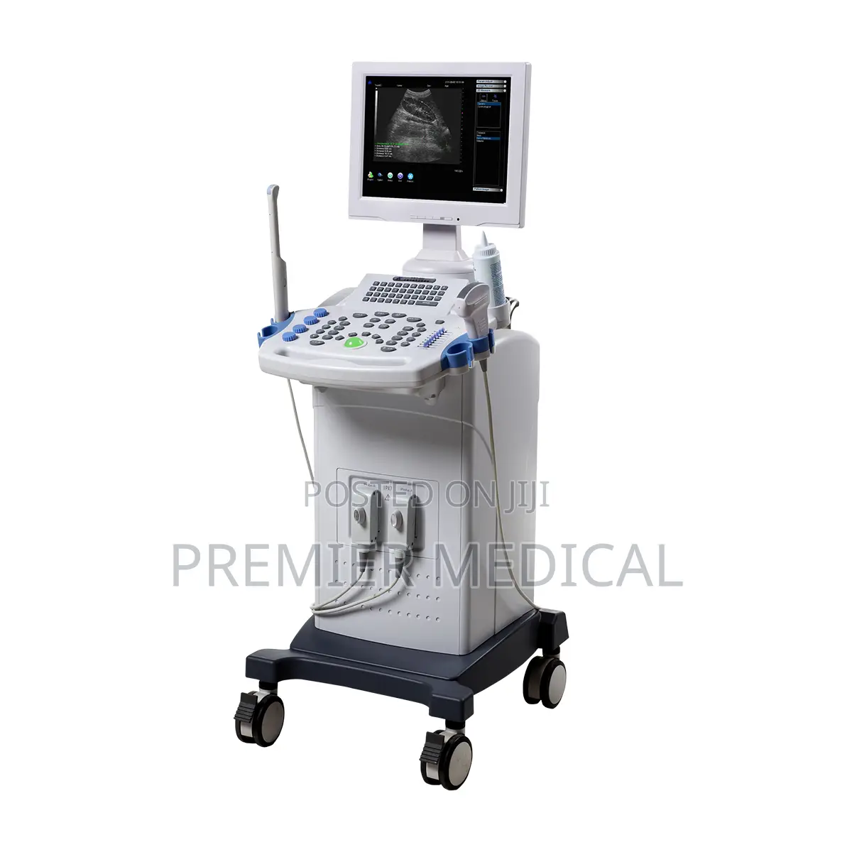 Full Digital Ultrasound System