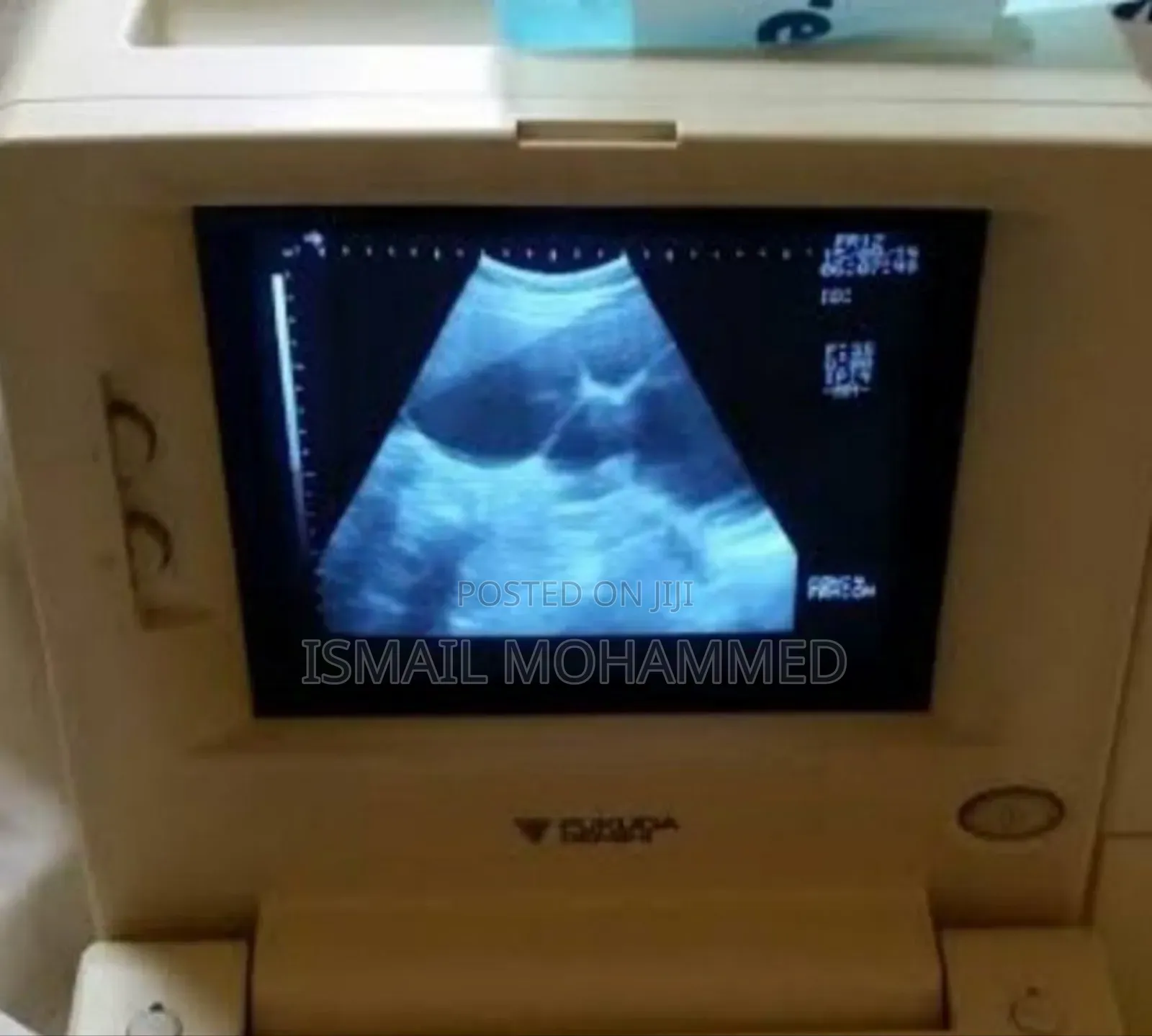 Fukuda Denish Ultrasound Machine