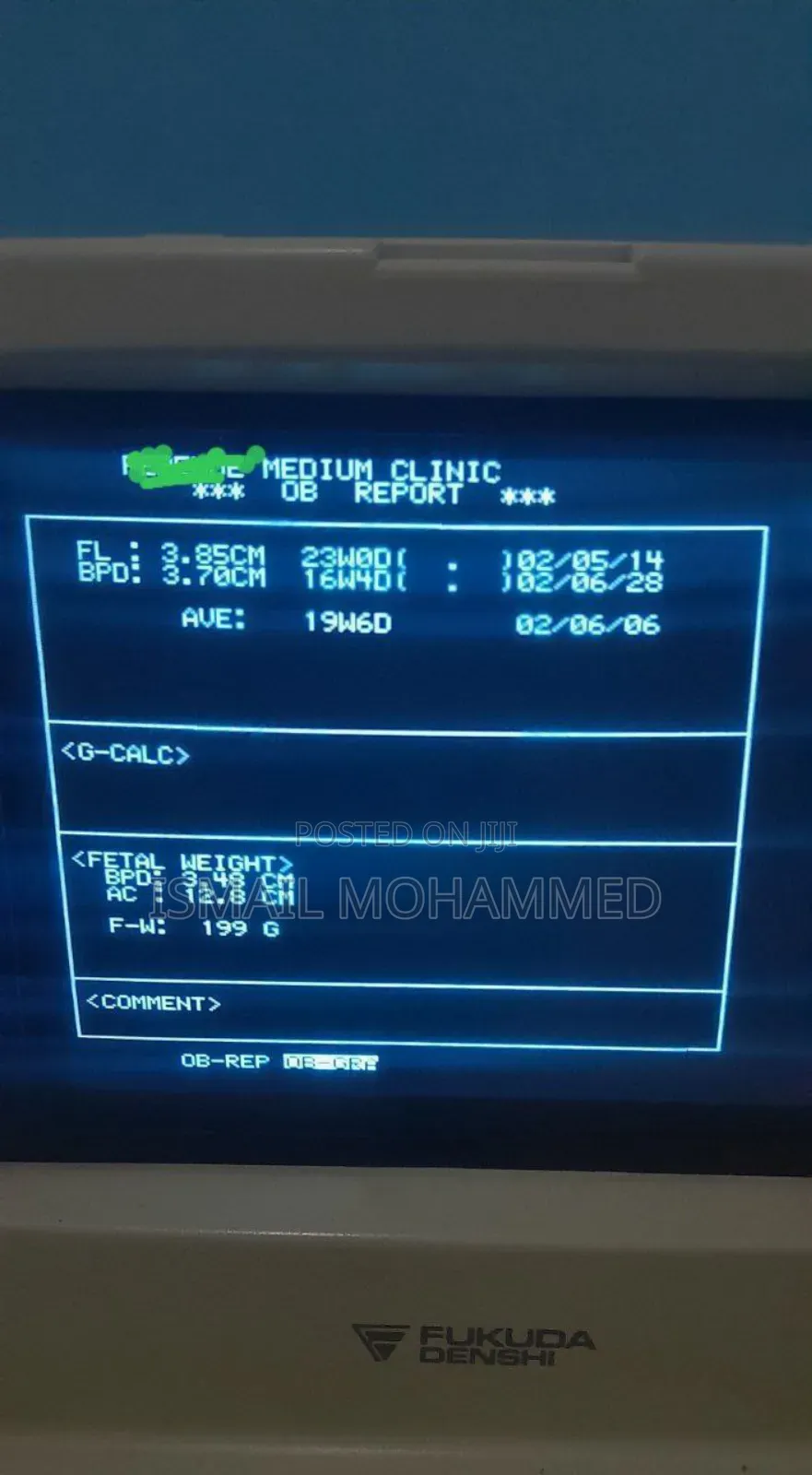 Fukuda Denish Ultrasound Machine