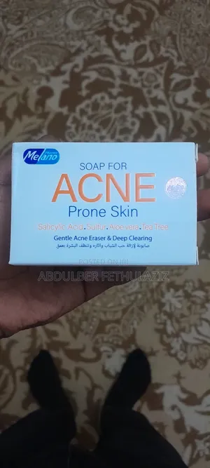 Photo - Acne Prone Skin