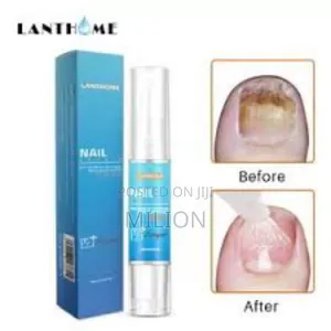 Photo - የጥፍር ፈንገስ፣ የተሰበሩ ጥፍሮች፣ ቀለም የተበላሸ ወይም የተጎዱ ጥፍሮችን ለማስተካከል የሚረዳ መድሀኒት ነው።