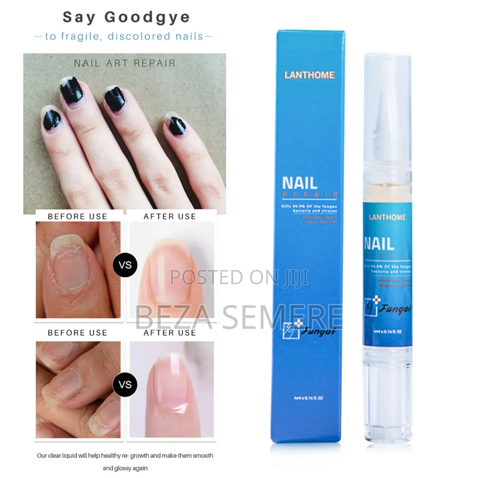 Lanthome Nail Repair Fathlip