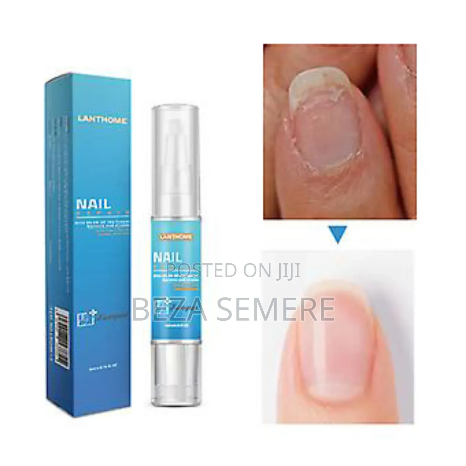 Lanthome Nail Repair Fathlip