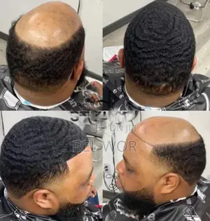 Photo - Men Wig ( Toupee) Human Hair