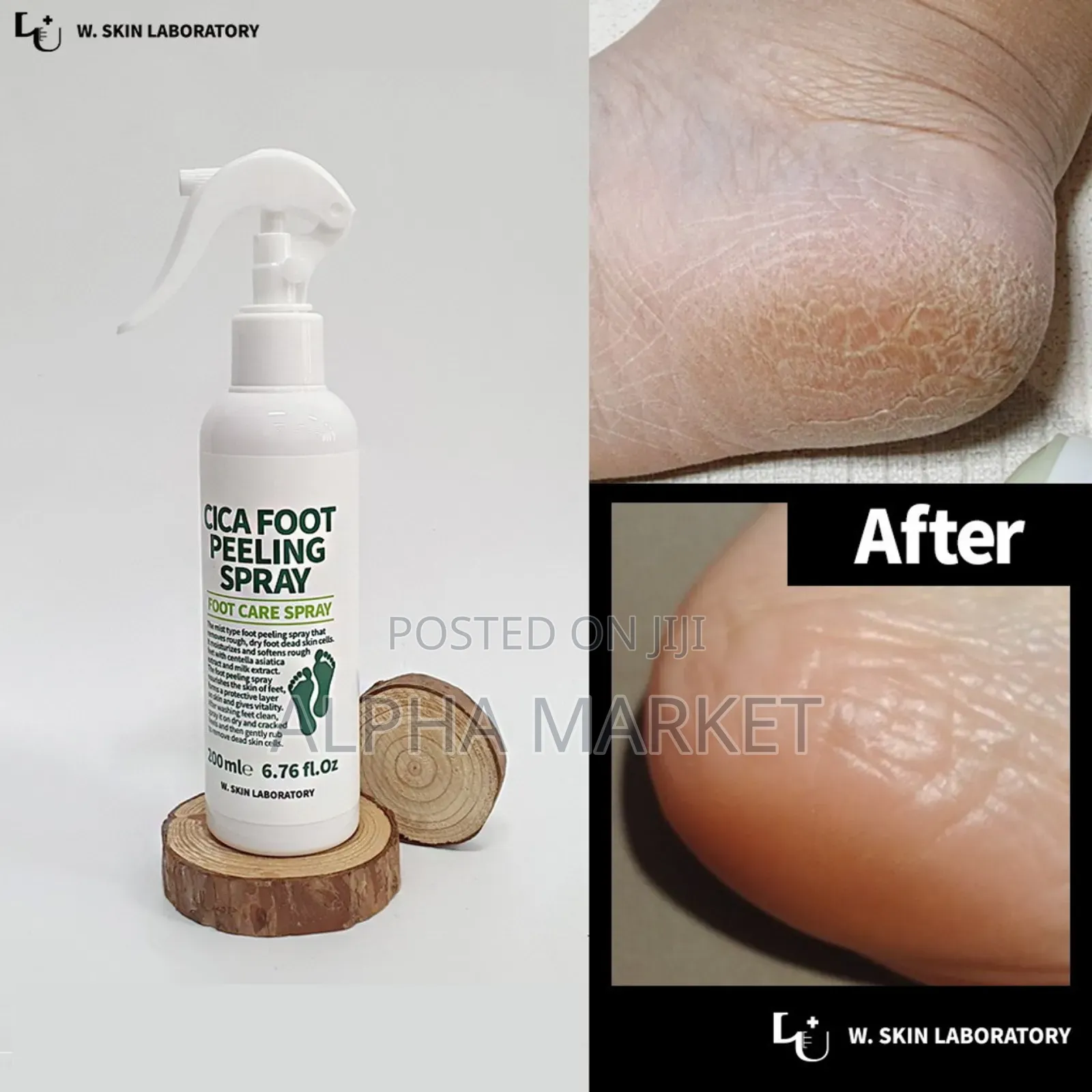 Foot Peelling Spray ለአግር ሽታ በዘላቂነት የሚቀርፍ