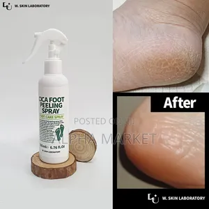 Photo - Foot Peelling Spray ለአግር ሽታ በዘላቂነት የሚቀርፍ