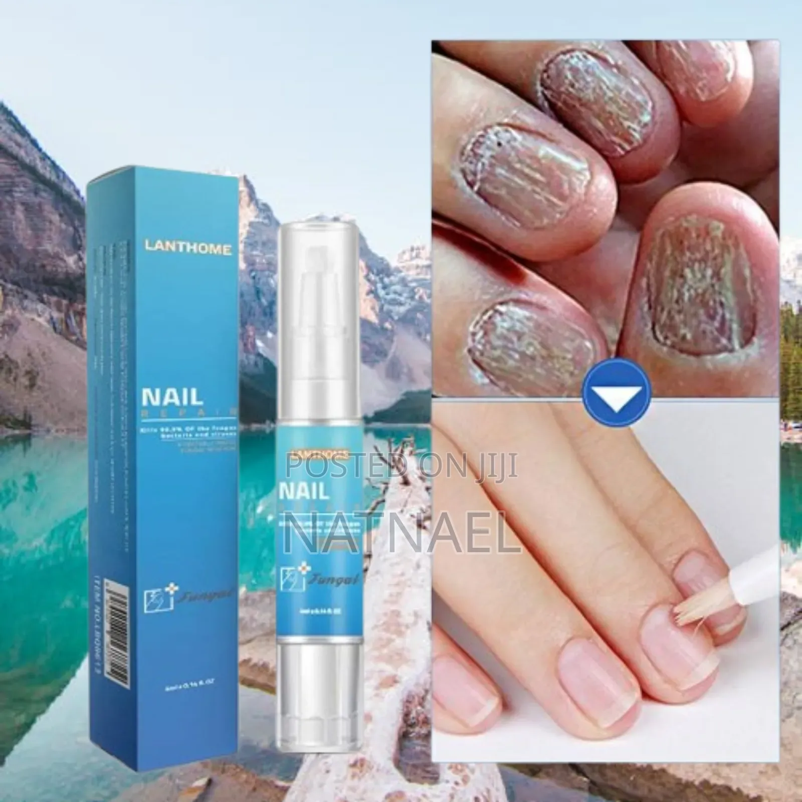 Lanthome Nail Repair