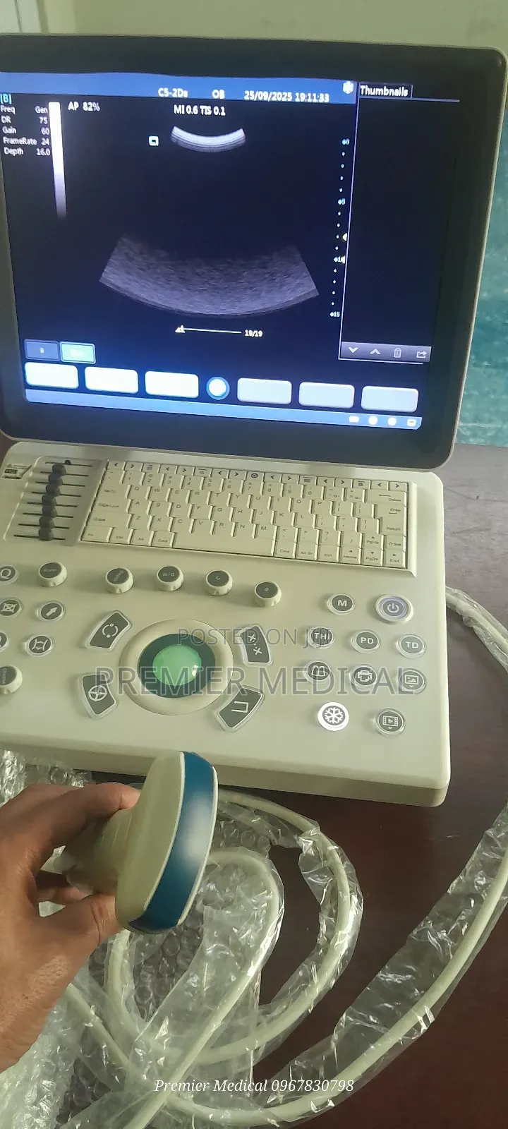 Ultrasound Machine