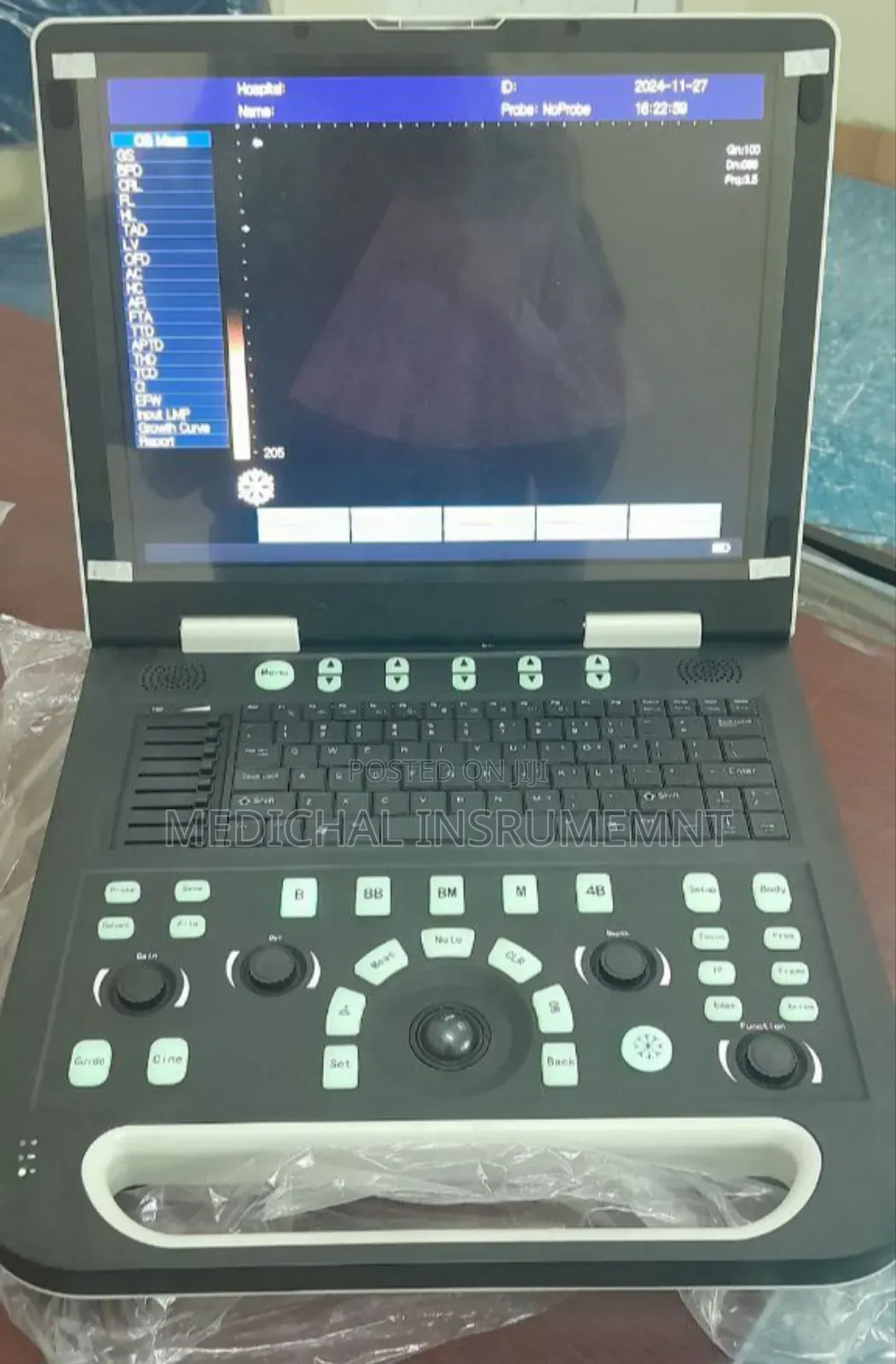 Sonostar Ultrasound Machine